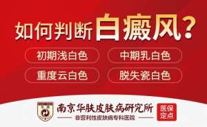 假期不“白”过！南京华肤端午期间，帮助白癜风患者准确检测