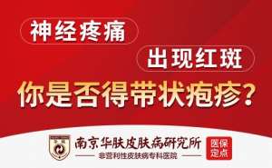 带状疱疹会再次发作吗“南京治疗汗疱疹的医院”